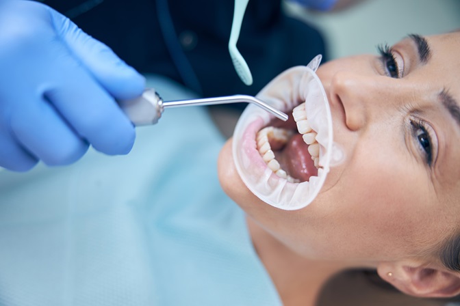 Causes of Tooth Infection That Require Root Canal Therapy