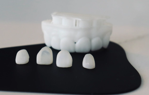 What are Veneers?